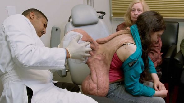 Zbavte mě toho nádoru (5)