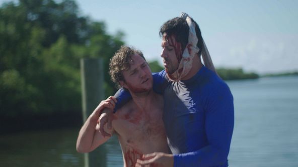 Něco mě kouslo! (7)