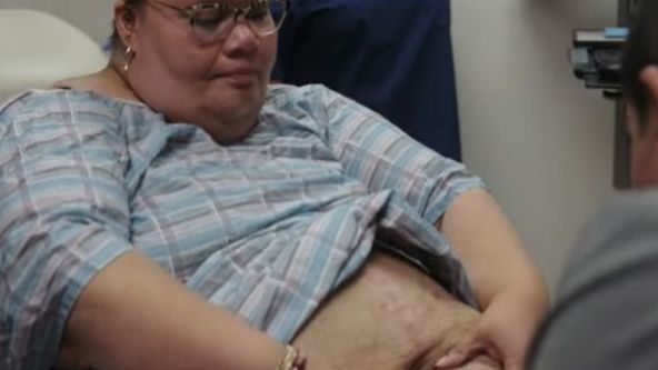 Zpackané operace proti obezitě (3)