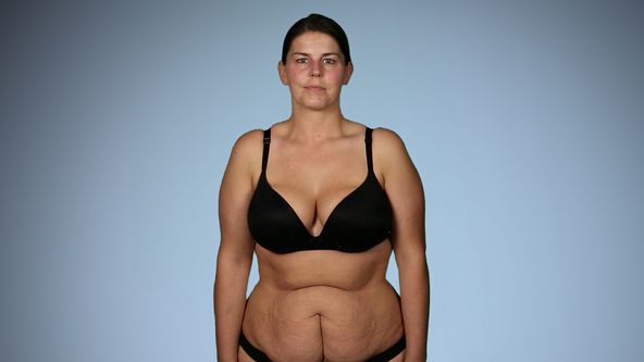 Spackané plastické operácie VII (7)